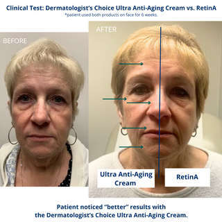 Ultra Anti-Aging Cream Extra-Strength Exfoliating Moisturizer with non-neutralized glycolic acid (AHA)