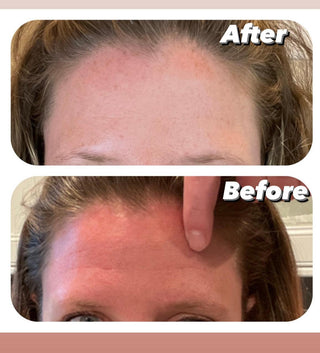 before and after The best anti aging skin set Wrinkles fine lines dark under eyes skin pigmentation sun damage dark spots uneven skin tone acne