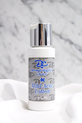 Mild Acne Lotion with Benzoyl Peroxide