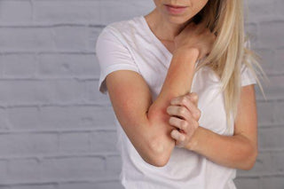 The Best Beginning Eczema Treatments According to a Dermatologist