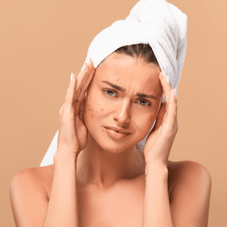 Glycolic Acid: Here's Why Those Initial Bumps are Your Passport to a Flawless Glow!