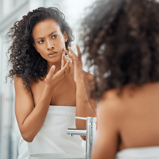 Types of Acne Scars + Why Glycolic Acid is the Best Solution for Removing Acne Scars